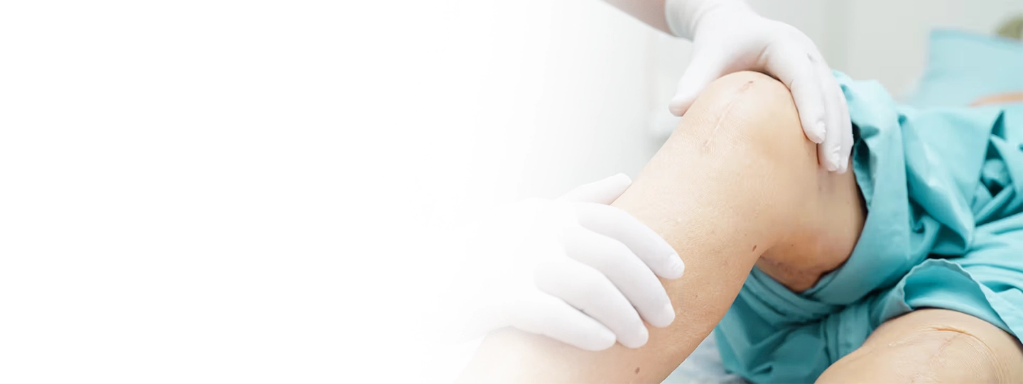 Benefits of Knee Replacement Surgery for Senior Citizens